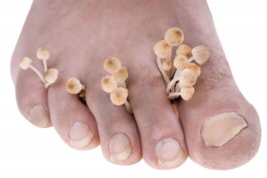 mushrooms on my toes