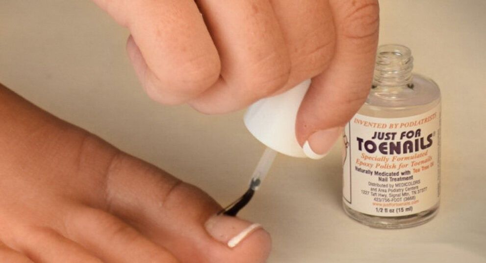 nail polish cures fungus on big toe