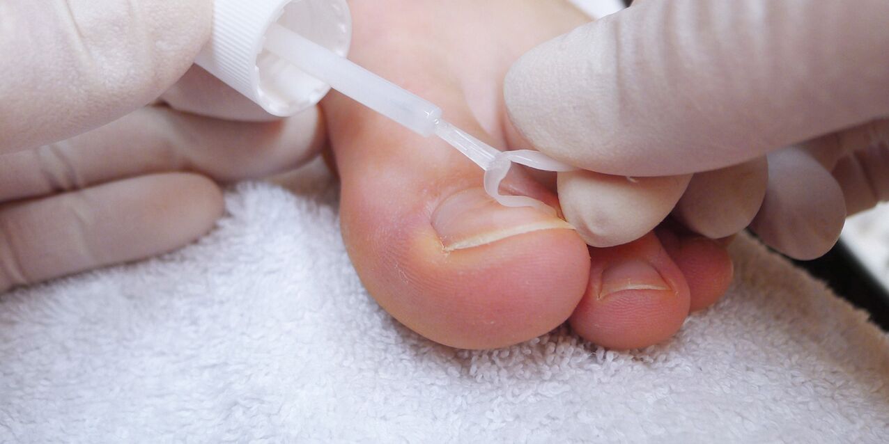 nail antifungal paint