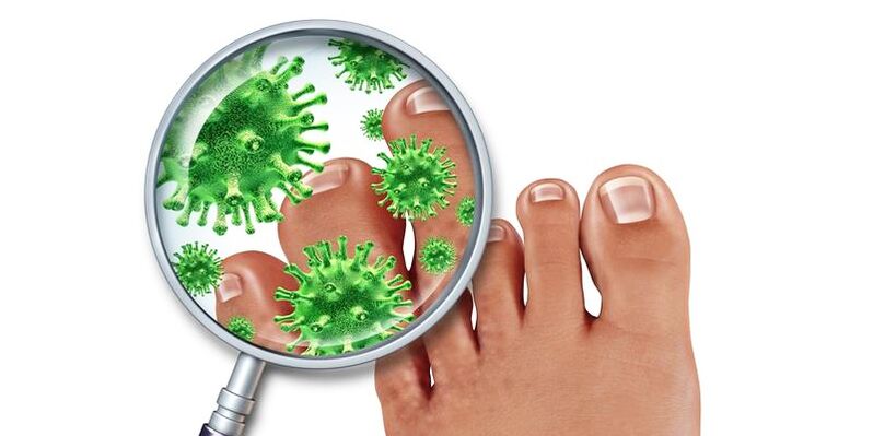 Nails are infected with fungal