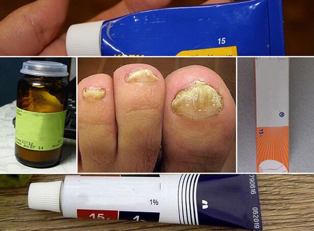 General principles for fungal treatment