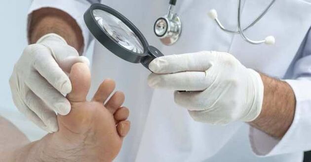 Check your feet for fungal infections
