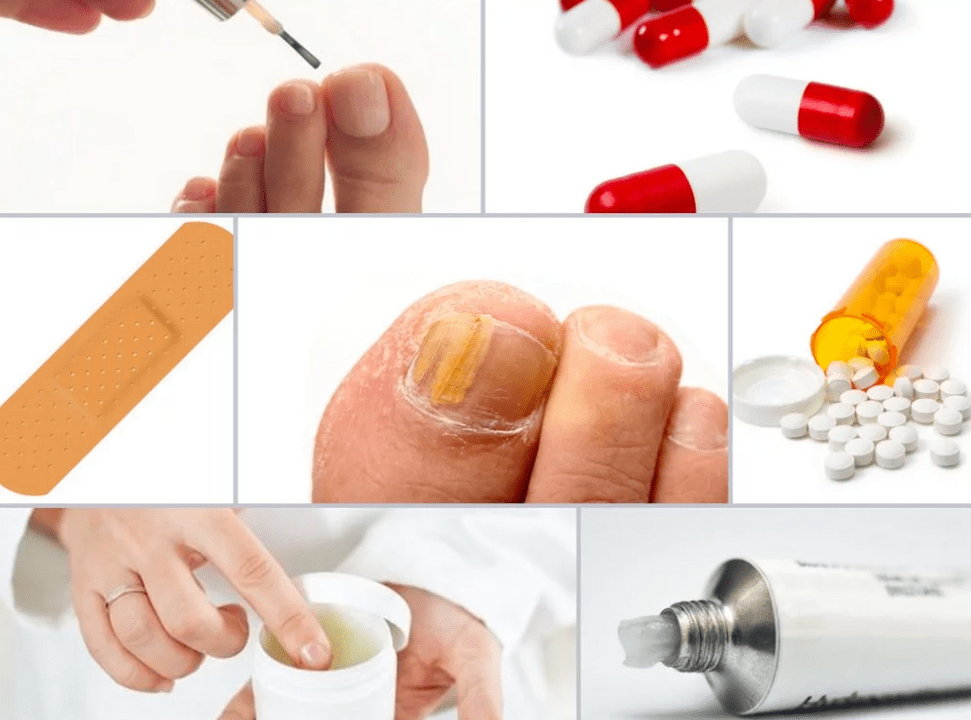 Systemic medicine for toenail fungus