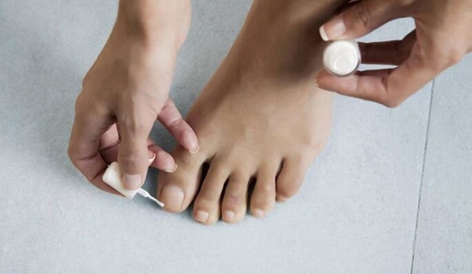 Treat the fungus of the big toe with varnish