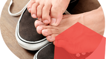 itchy skin feet, fungal infection symptoms